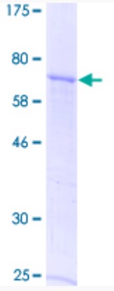 SDS-PAGE (GDF9-4830H).jpg